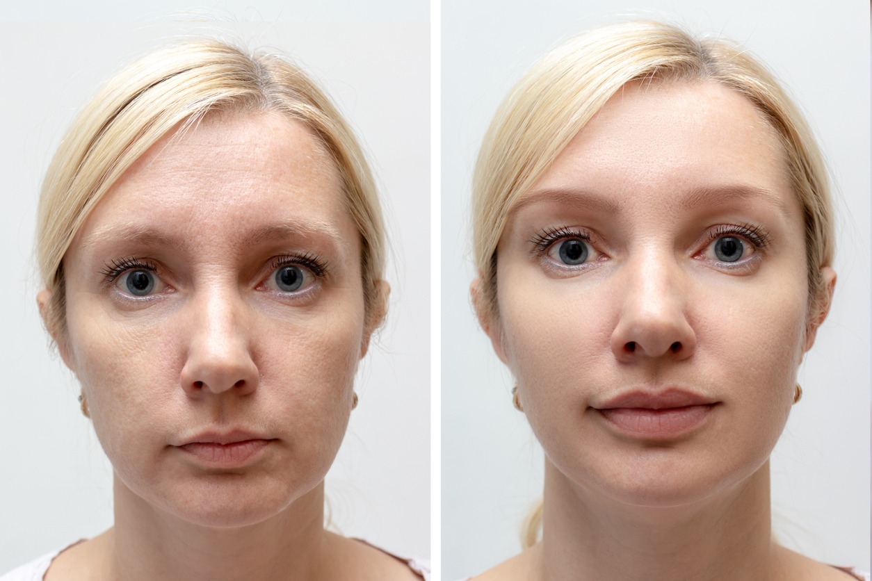 Enhanced Facial Harmony