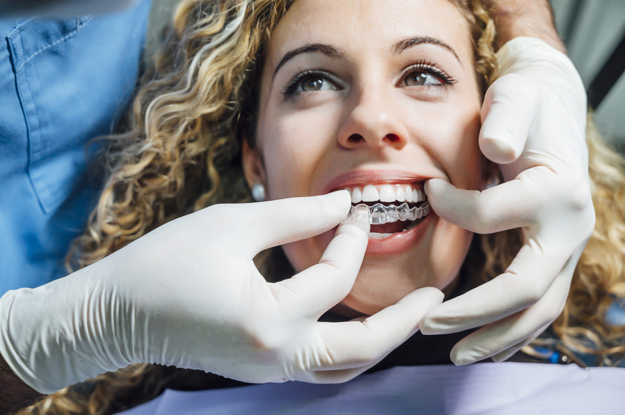 Doctor putting a clear dental aligner to the patient