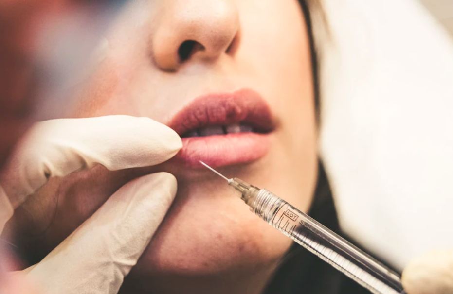 woman being injected on the lips
