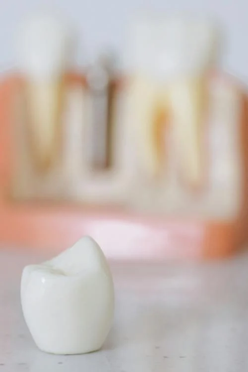 How to Avoid Teeth Stains