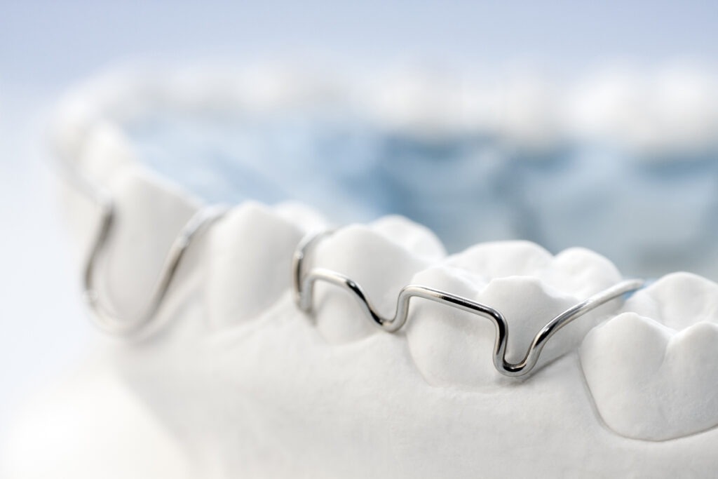 Close up of orthodontic braces stock photo