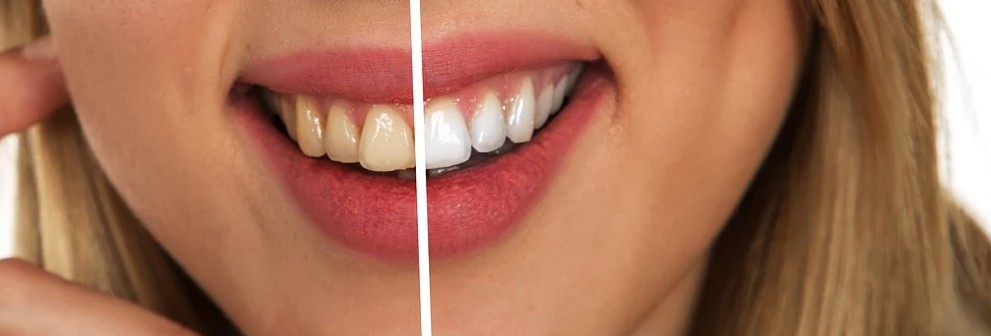 Naturally Whitens Your Teeth