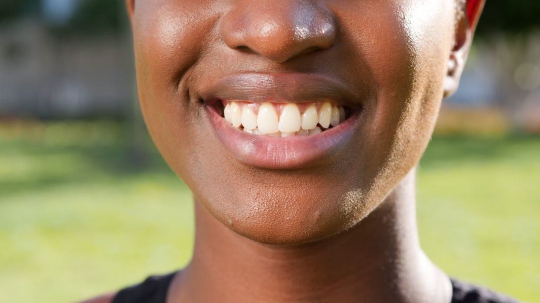 Image showing a woman smiling, showing her teeth.