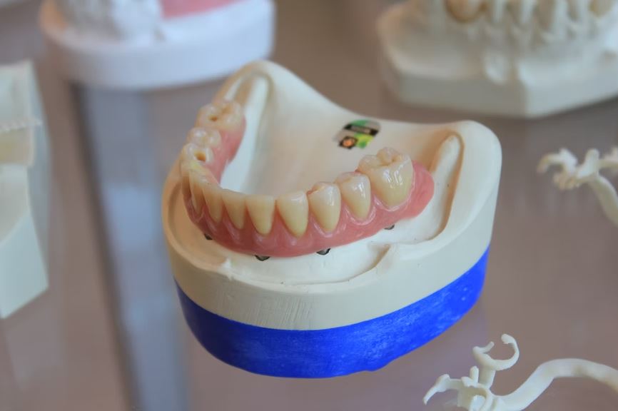 Replacement of enamel