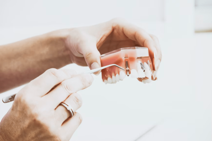 What Are the Benefits of Seeing a Prosthodontist