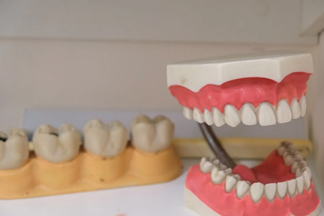 What is Dental Bridging and what are its Benefits