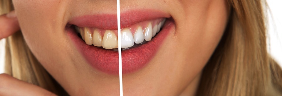 teeth-dental-care-white-white-teeth