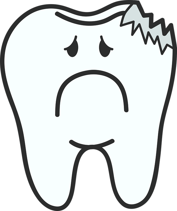 illustration of a chipped tooth 