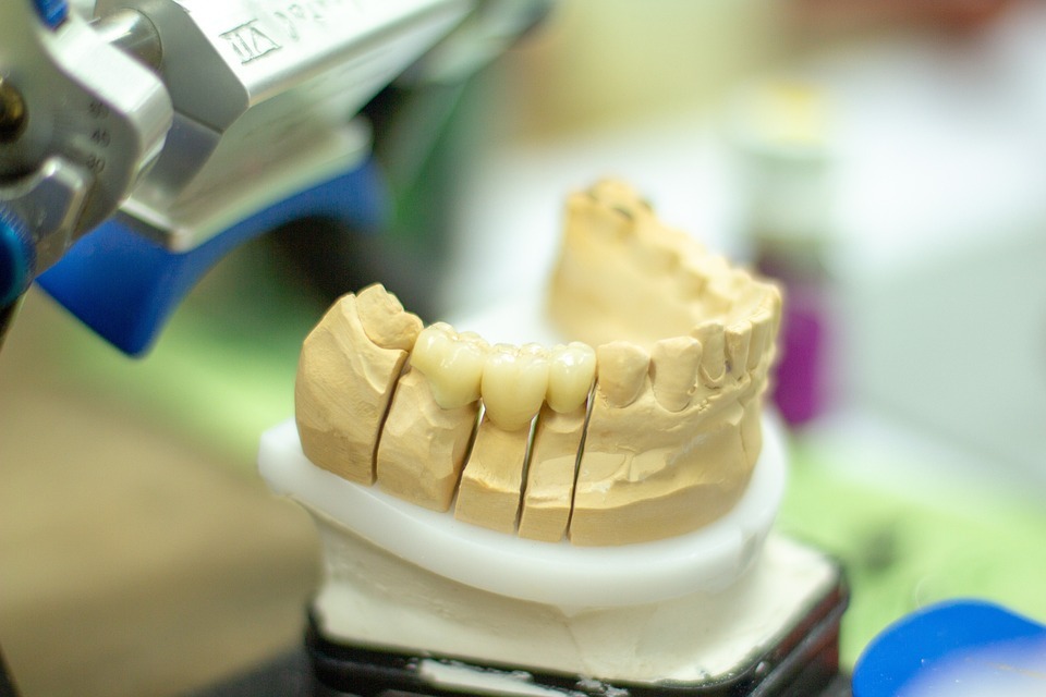 Preparation of a denture