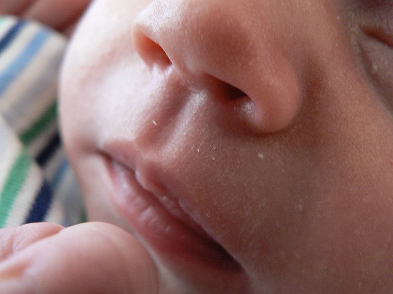 Philtrum-of-a-one-month-old-baby