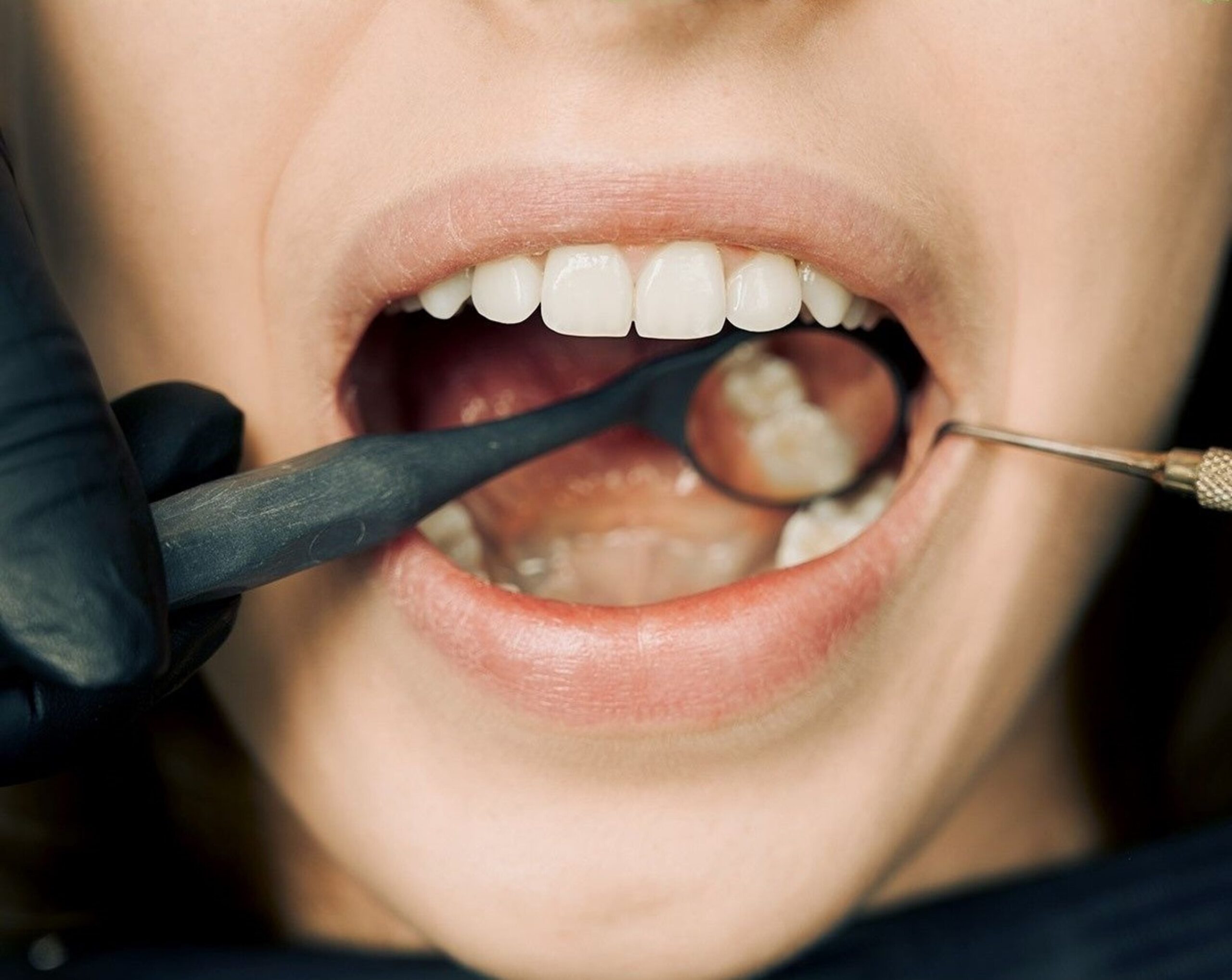 Navigating the Landscape of Dental Complications: Causes, Prevention, and Treatment