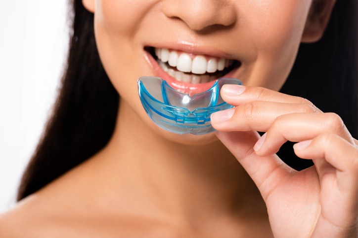 Custom Mouthguards: Protecting Your Smile in Style