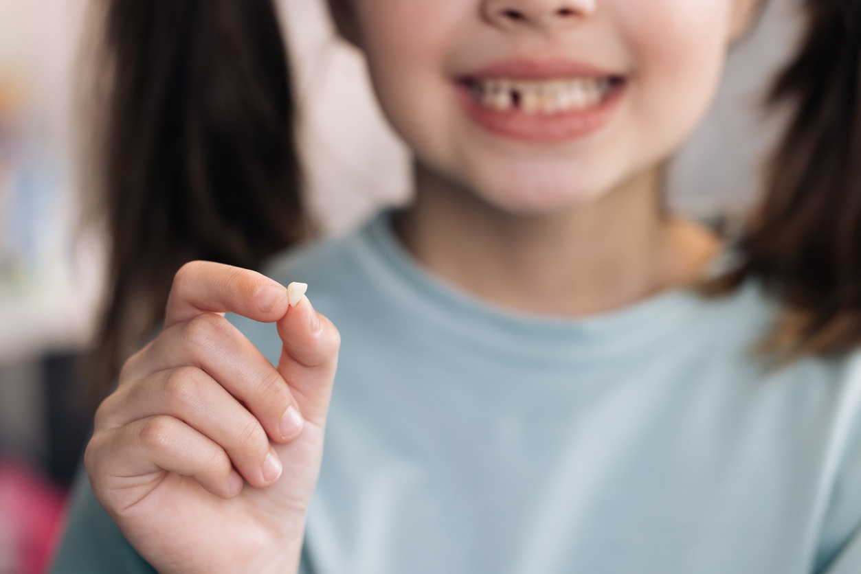 Little Girl Loosing her baby teeth. Little girl with milk temporary tooth. Happy child holding her fallen tooth in hand. Dental medicine or temporary teeth health care concept